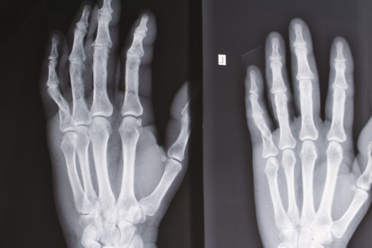 インドのワクチン戦略：健康を守る新たな旅路